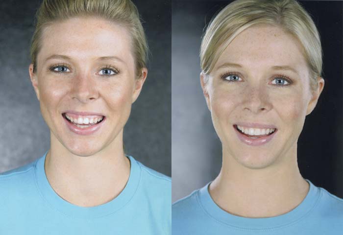 Before and After
