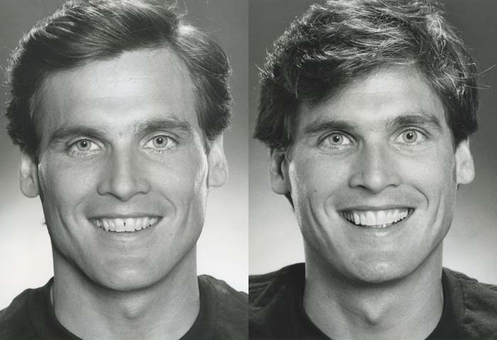 Before and After