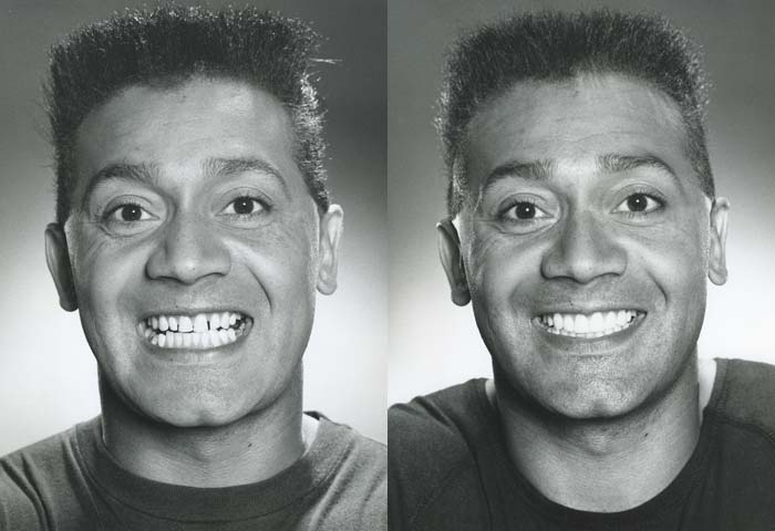 Before and After