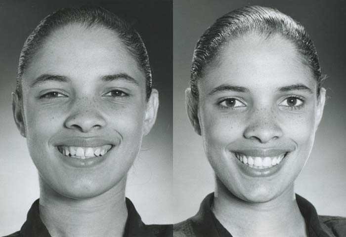 Before and After