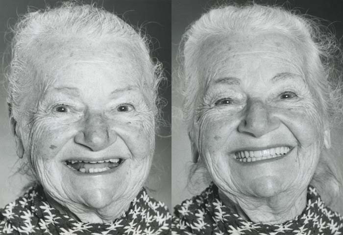Before and After